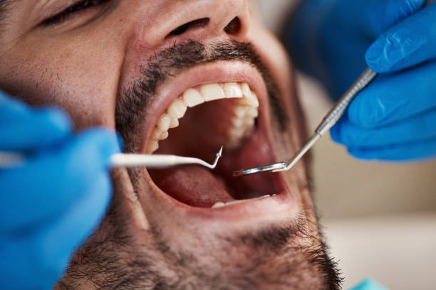 Best Emergency Denture Repair in Athens, IL