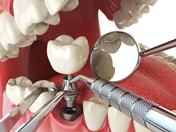 Best Weekend Emergency Dentist in Athens, IL