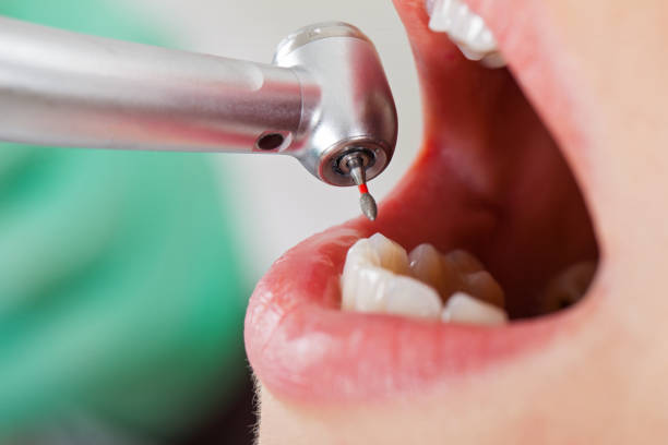 Best Urgent Care for Lost Fillings or Crowns in Athens, IL